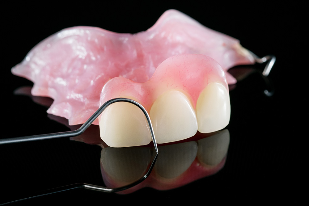 Частичный съемный протез из пластмассы на передние верхние зубы