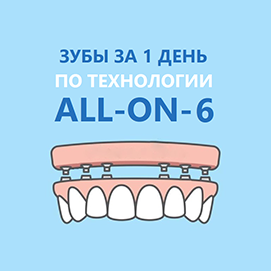 Полная имплантация челюсти Все-на-6 имплантах AB Dental, Noris Medical за 170 000 рублей