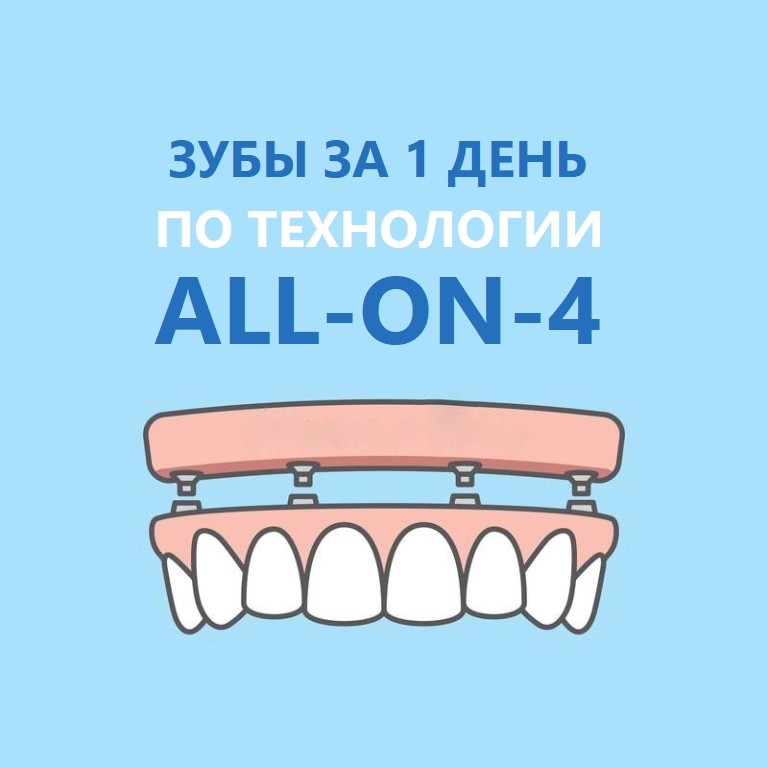 зубы за 1 день по технологии all-on-4