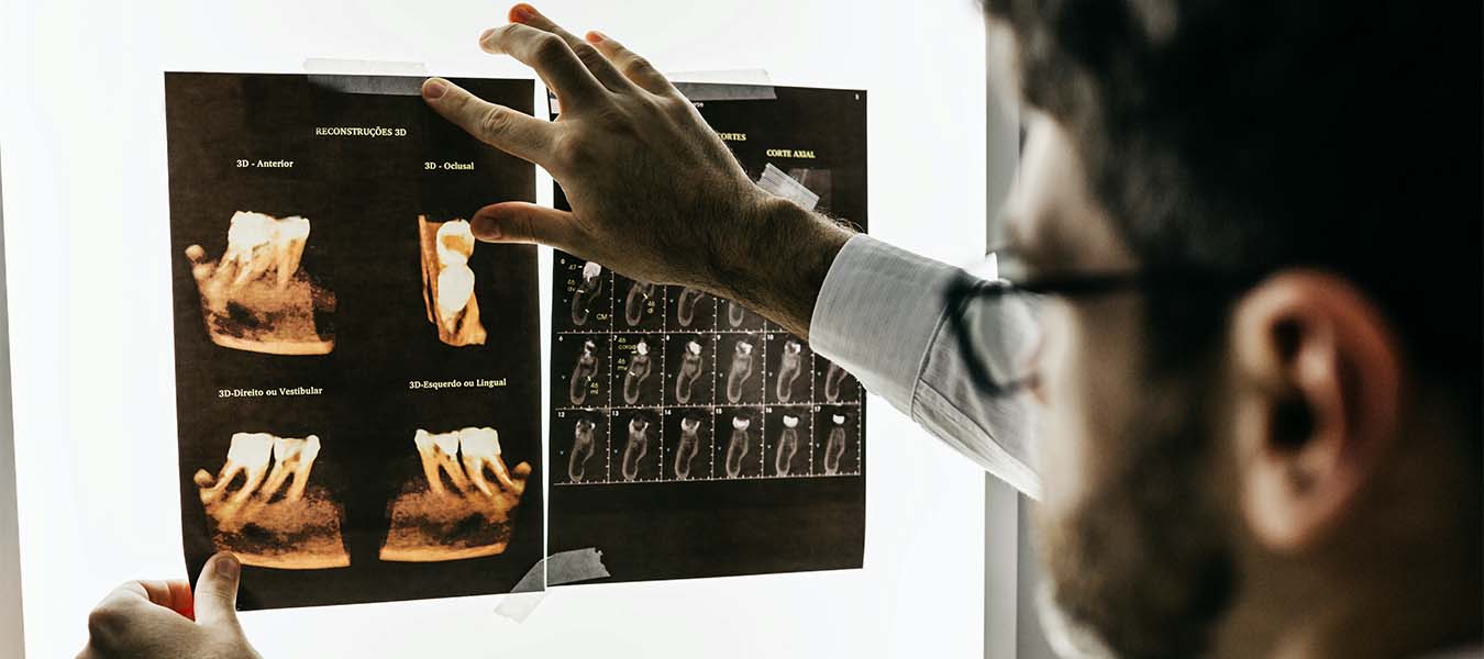 Специалист смотрит рентгеновские снимки челюсти