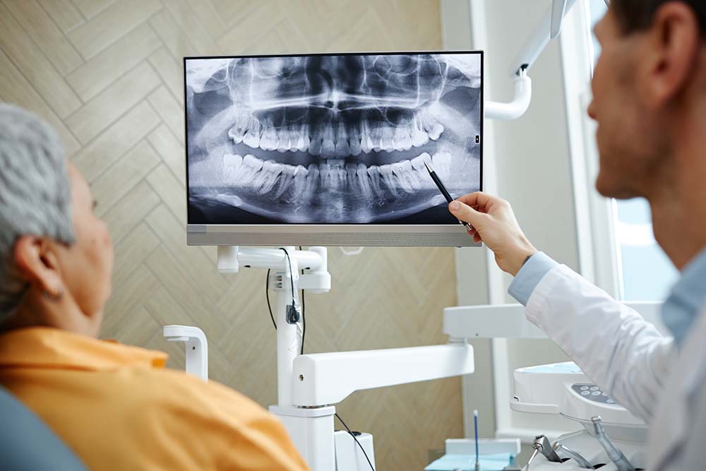 Врач обсуждает результаты КТ перед установкой импланта зуба