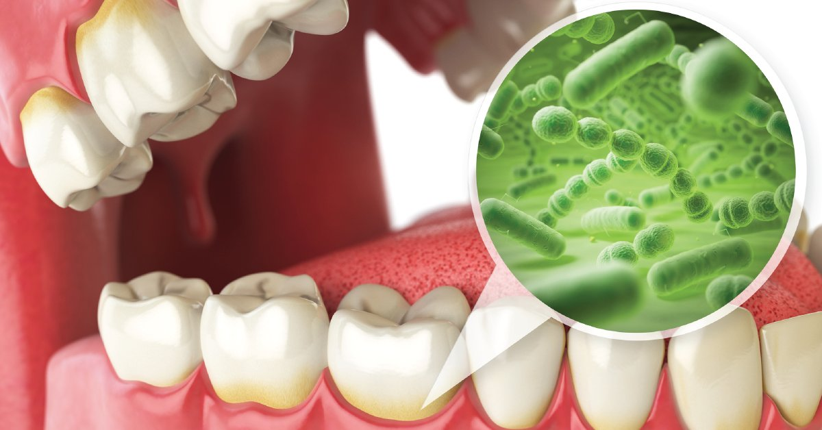 Перед назначением антибиотиков рекомендуется сдать посев на микрофлору полости рта