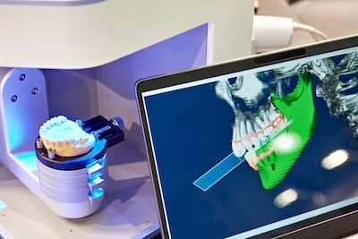 Создание 3D модели челюсти и планирование операции с учетом особенности кости пациента